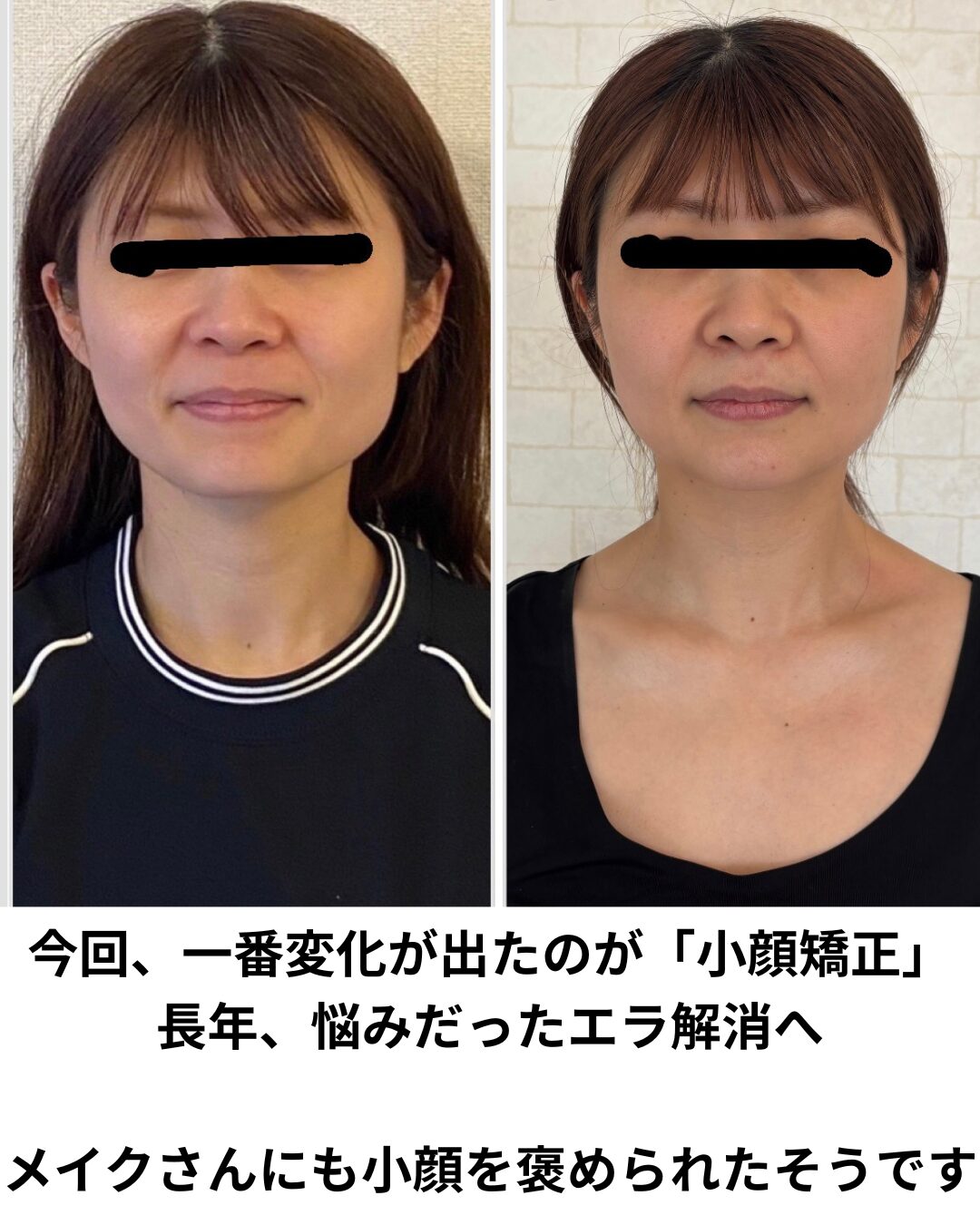 Voice Image 1